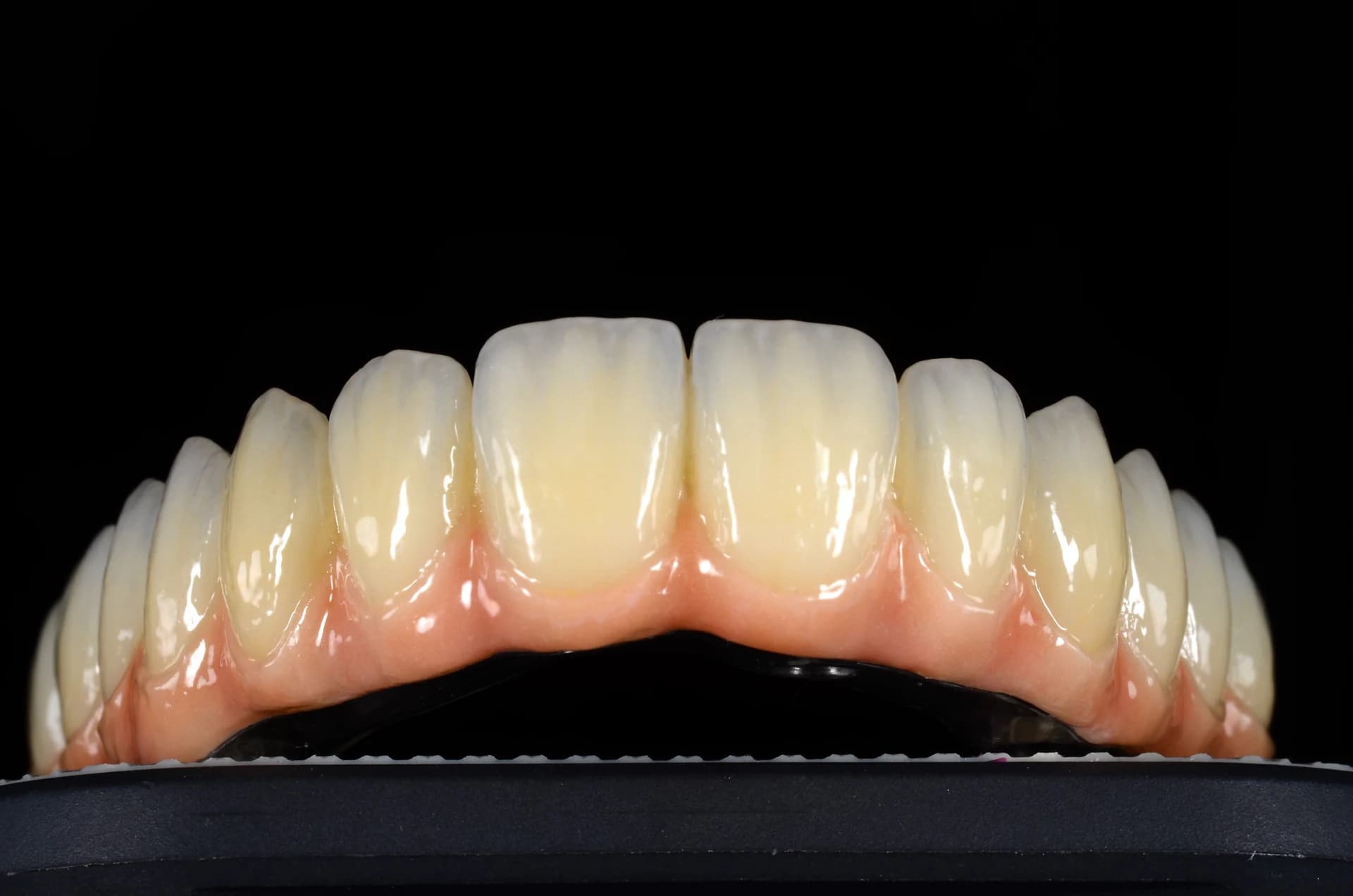 Full-arch restoration with a pink base, frontal view