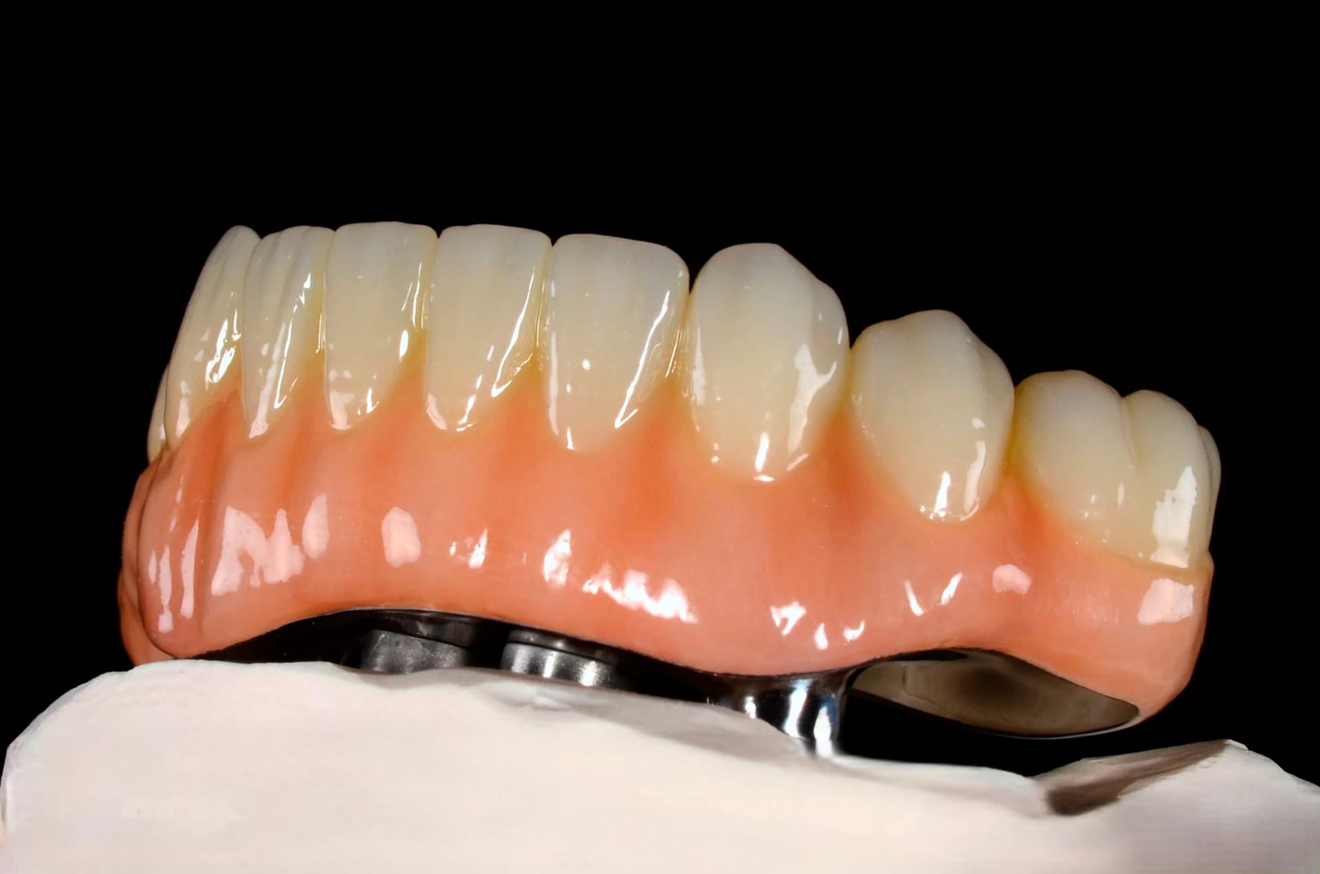 Full-arch restoration with a pink base on a model, left-side view