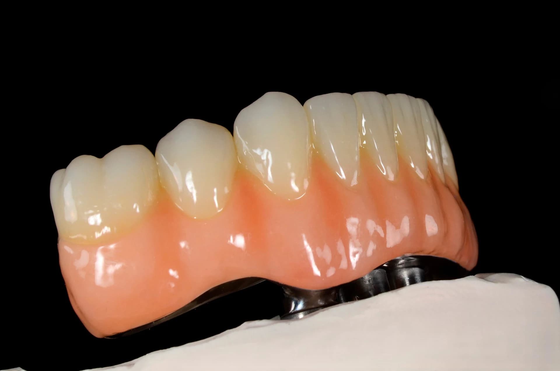Full-arch restoration with a pink base on a model, right-side view