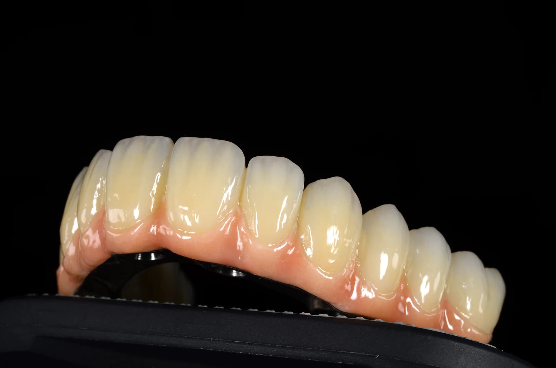 Full-arch restoration with a pink base, left-side view