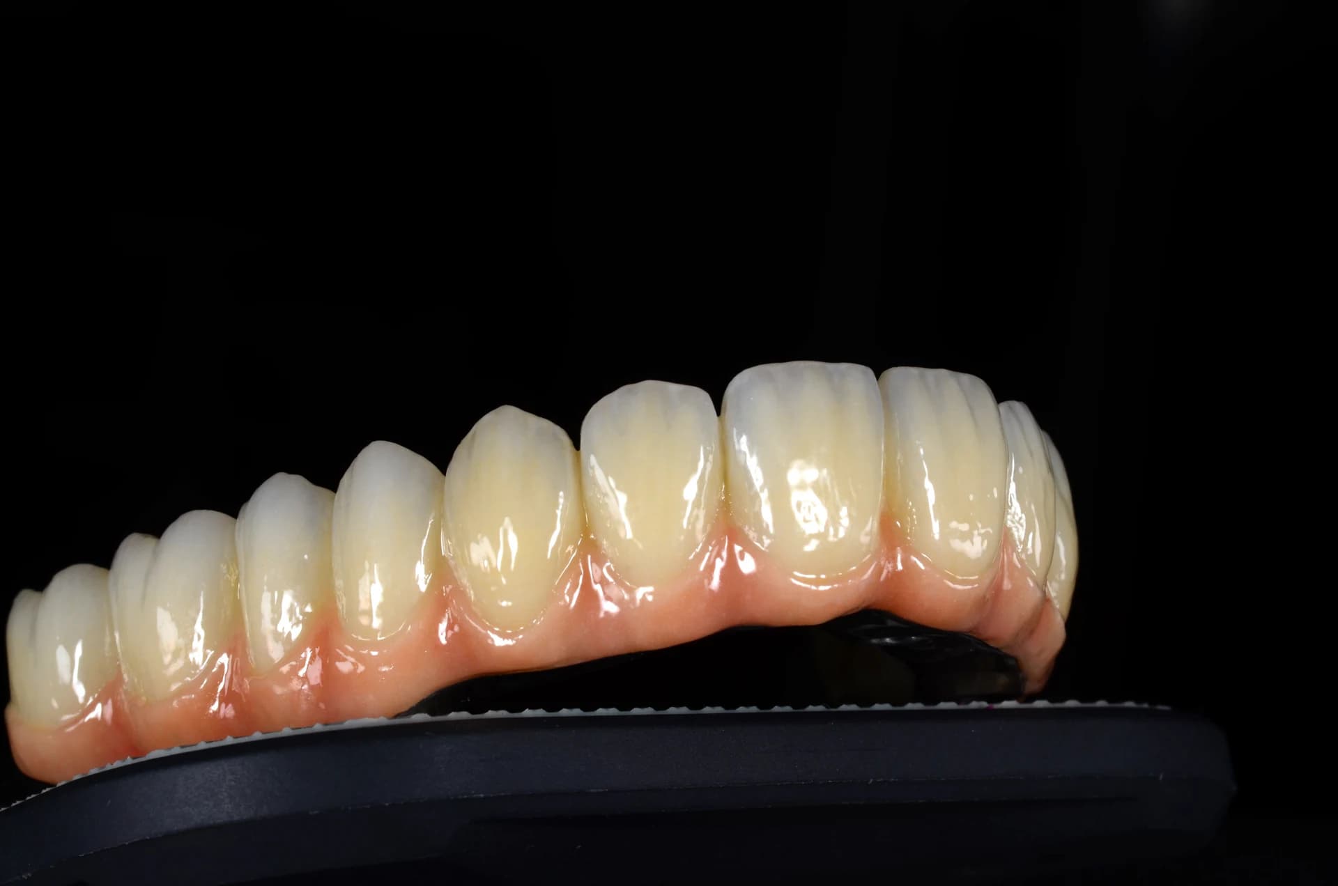 Full-arch restoration with a pink base, right-side view