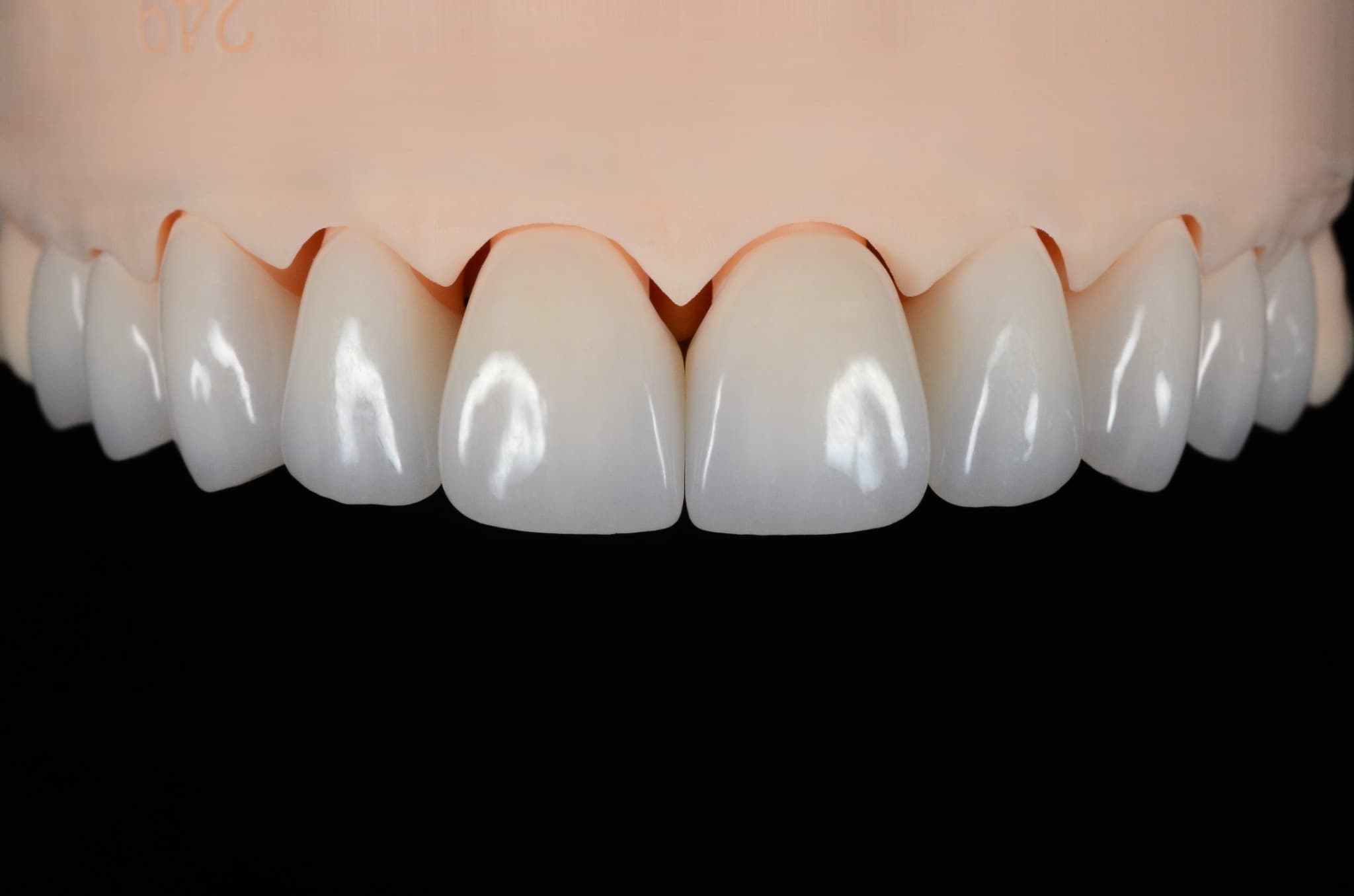 Przykładowe prace protetyczne