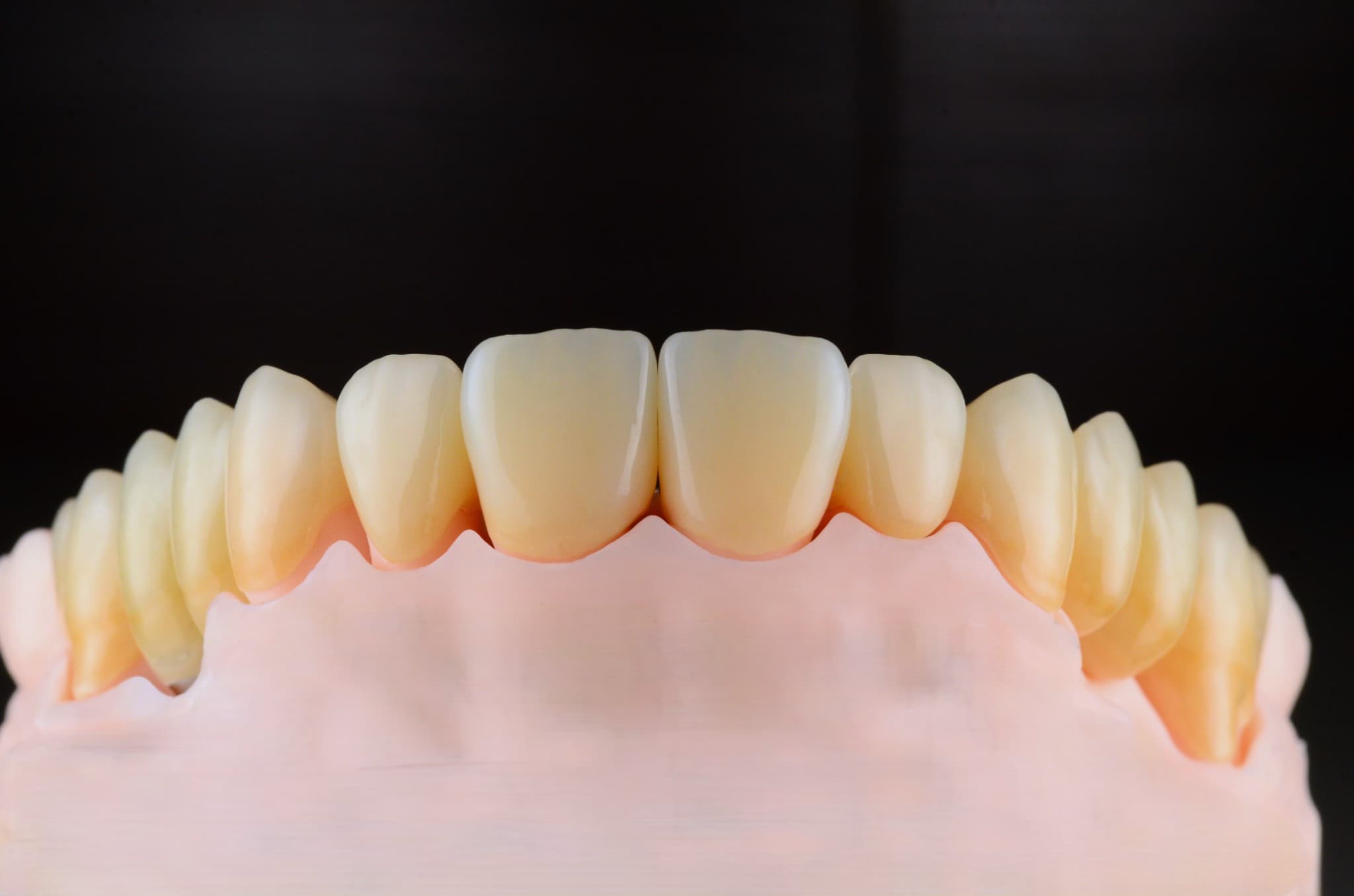 Przykładowe prace protetyczne