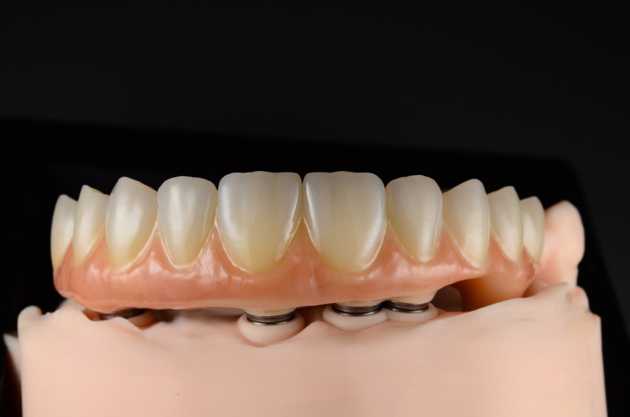 Przykładowe prace protetyczne