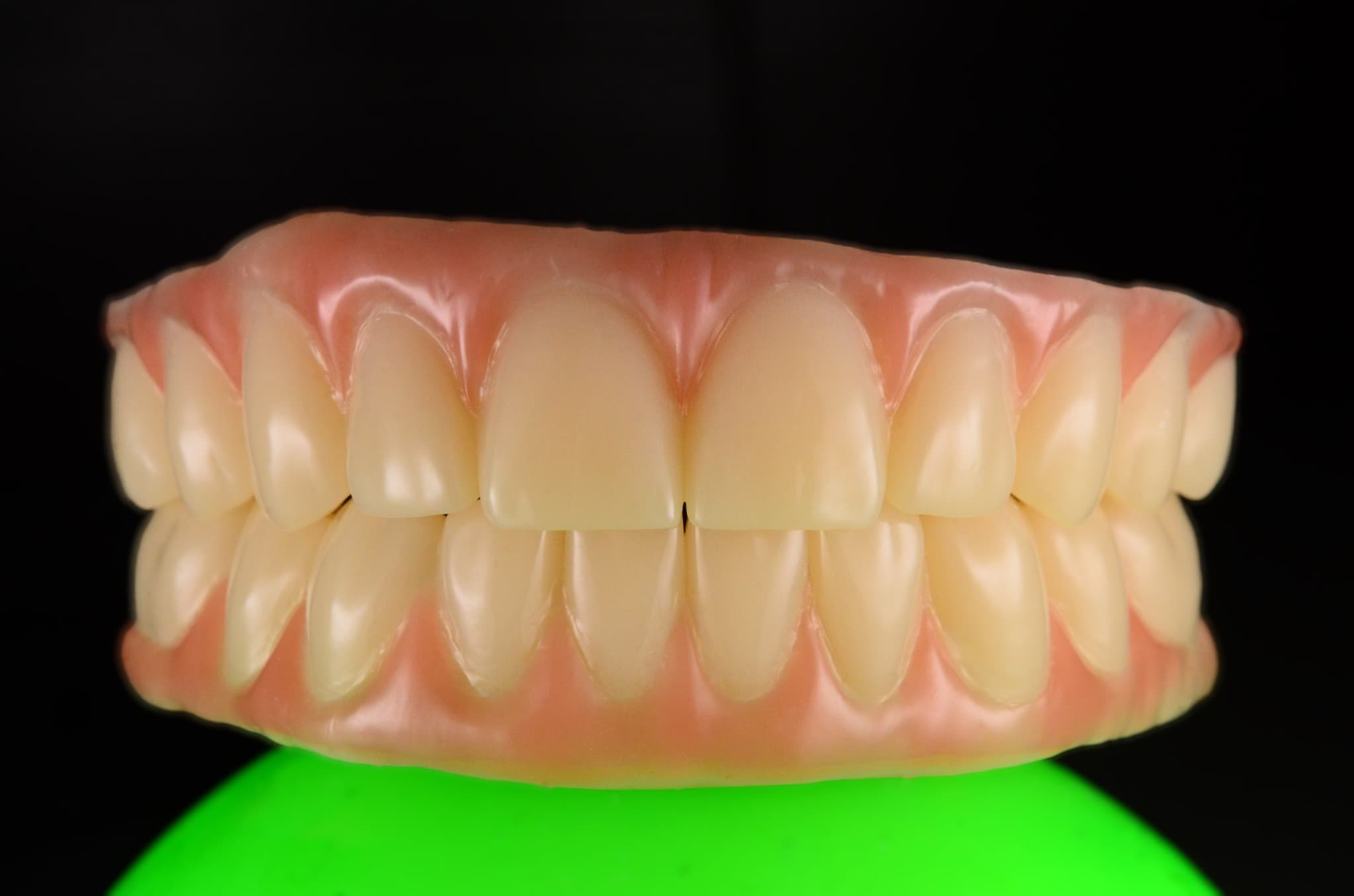 Przykładowe prace protetyczne