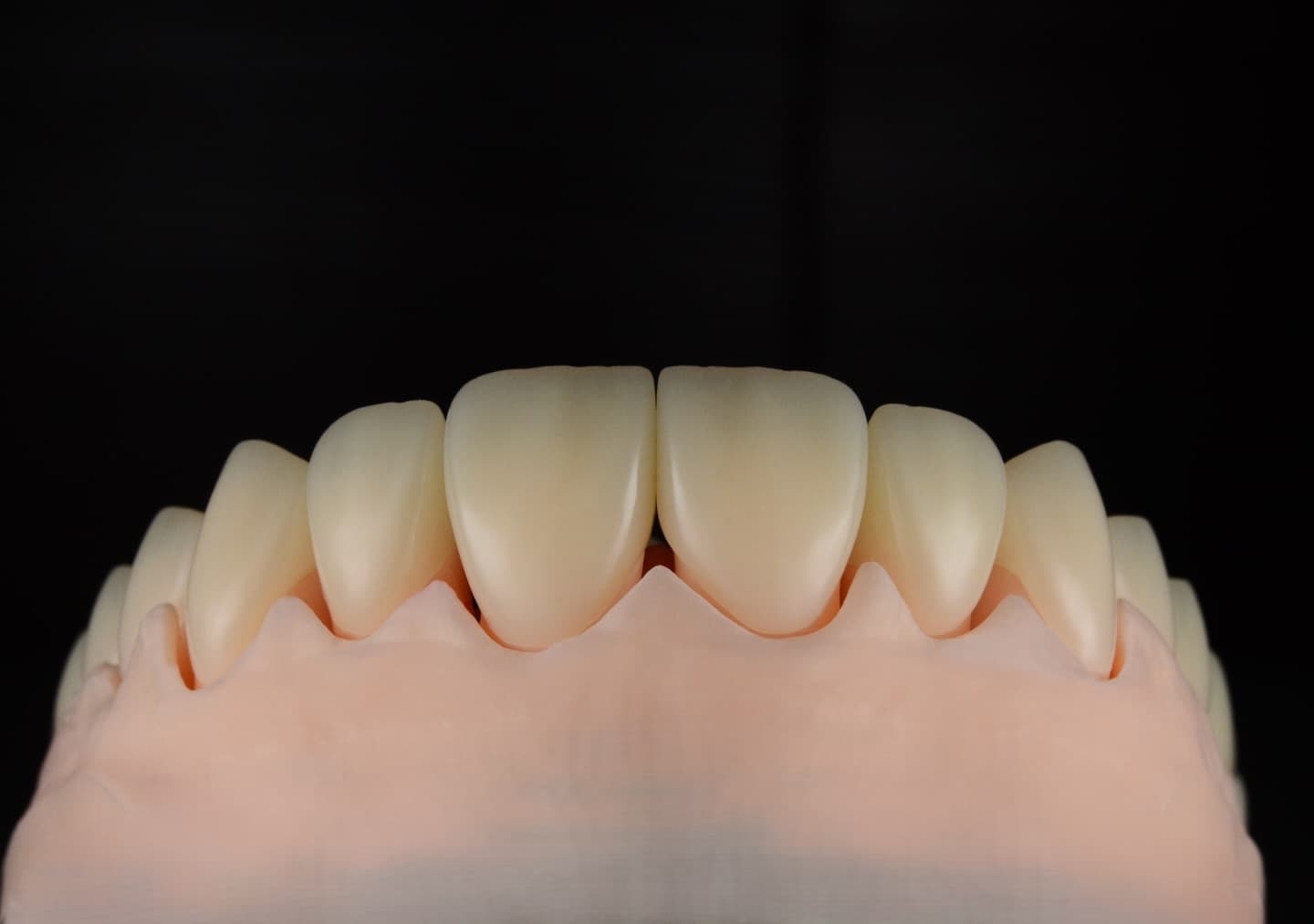 Przykładowe prace protetyczne