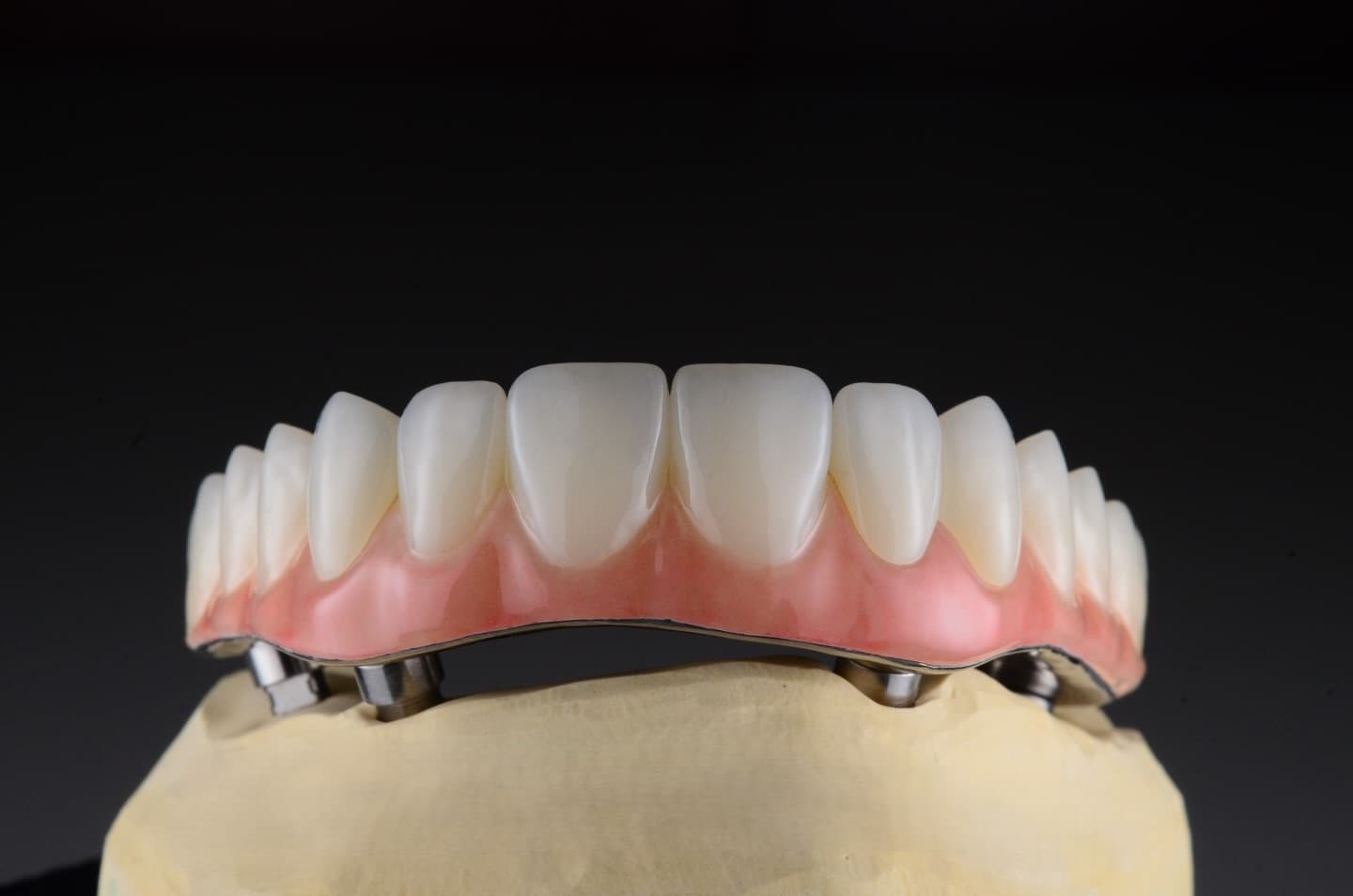 Przykładowe prace protetyczne