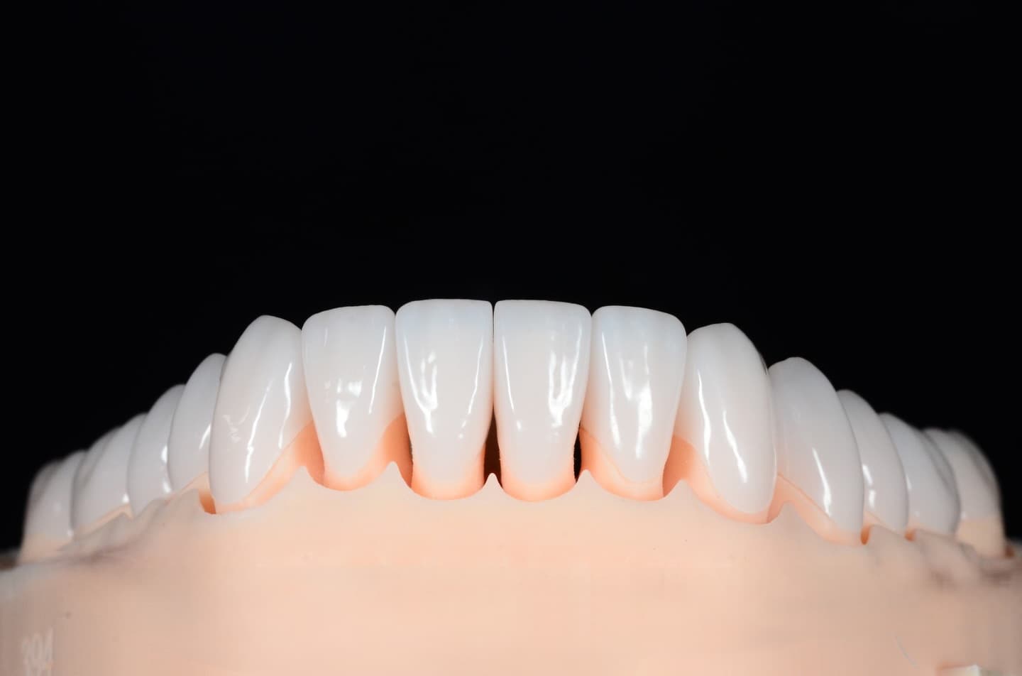 Przykładowe prace protetyczne