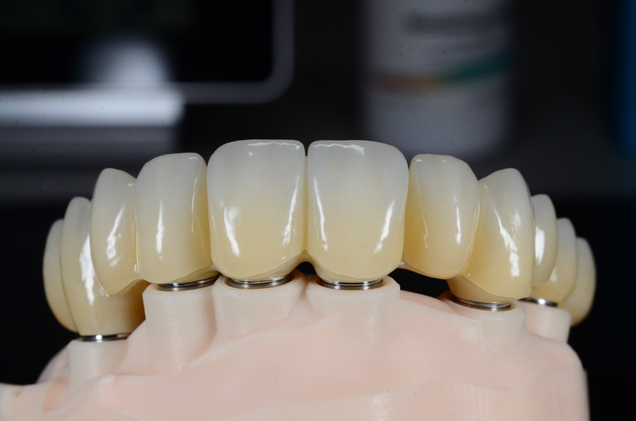 Przykładowe prace protetyczne