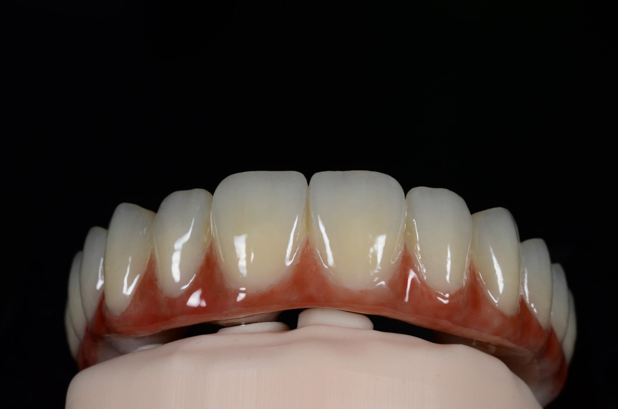 Przykładowe prace protetyczne