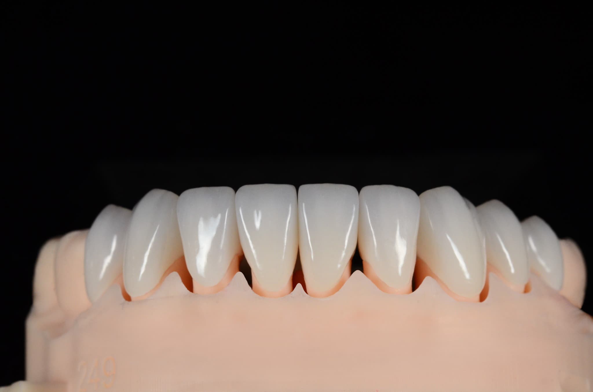 Przykładowe prace protetyczne