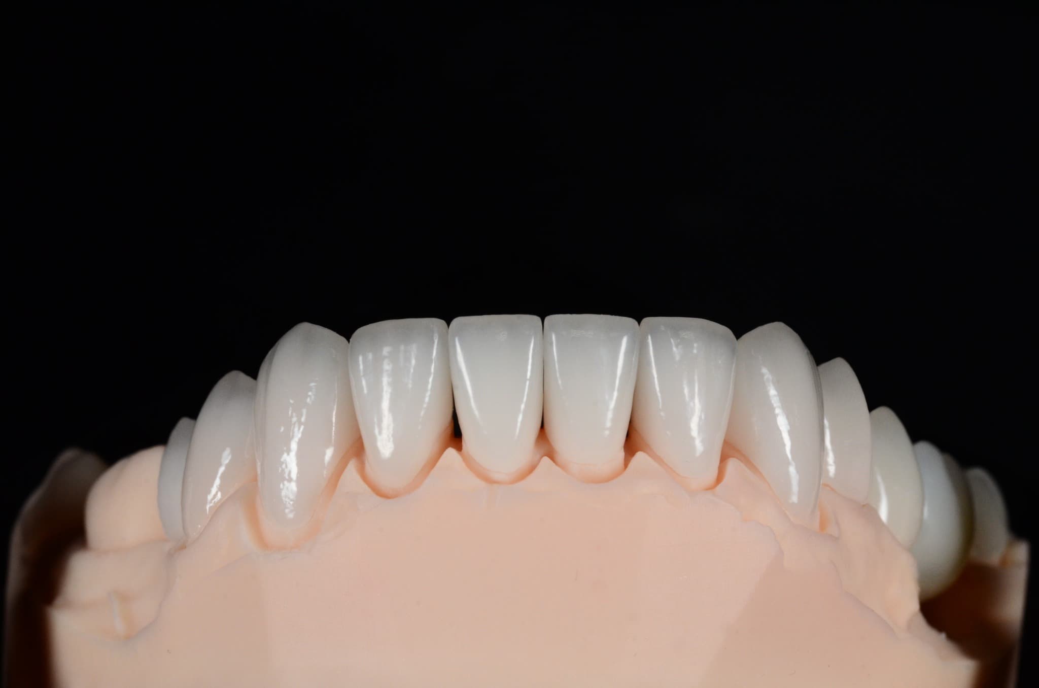 Przykładowe prace protetyczne